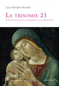 Trisomie 21 : Perspective historique sur son diagnostic et sa com