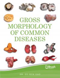 Gross Morphology of Common Diseases