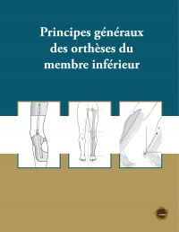 Principes généraux des orthèses du membre inférieur