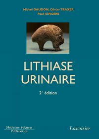 La lithiase urinaire