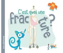 C'est quoi une fracture ?